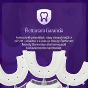 Lunalux Brilliant Smile fogkefe - ÚJDONSÁG